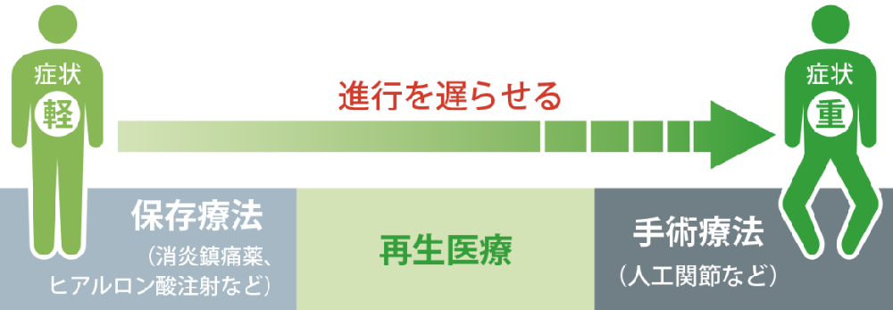 膝盖痛不再怕，告别关节置换，不动刀就能修复！