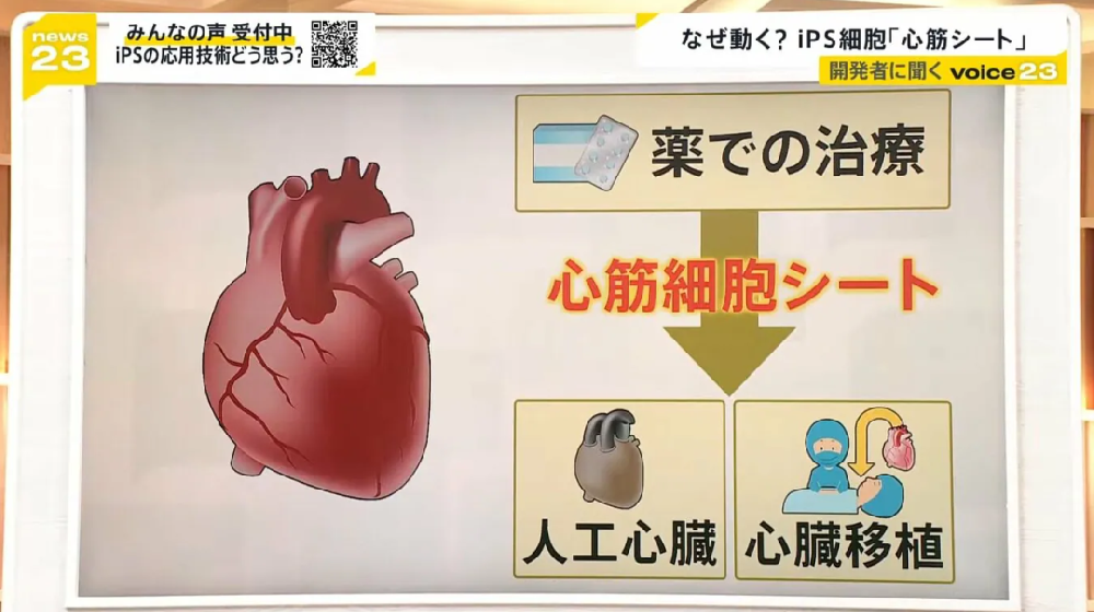 心脏坏了也能修？日本iPS细胞再爆“诺奖级”突破：不换心、不开胸，让心肌细胞“死而复生”